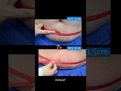 Freeze Fat, Lose 4 cm in 1 Hour!