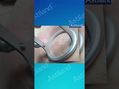 HIFU vs CO2 Laser, which anti-aging treatment you prefer?