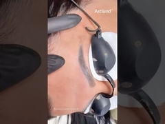 Nd Yag Laser for eyebrow tattoo removal #ndyaglaser #tattooremovallaser #beautymachine #laserclinic