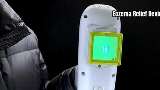 Eczema Relief: 308nm Excimer Light Therapy Device