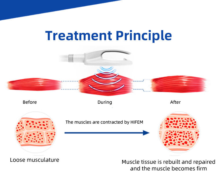 4 Handles EMS Muscle Building Machine for Body Sculpting